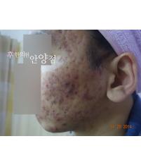 전후사진