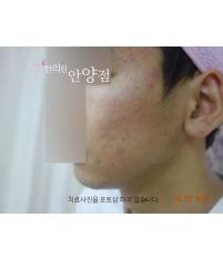 전후사진