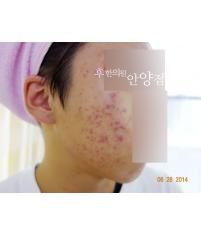 전후사진