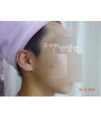 전후사진
