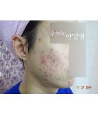 전후사진