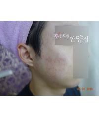 전후사진