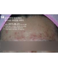 전후사진