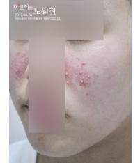 전후사진