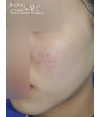 전후사진