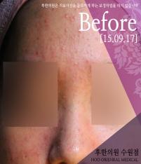 전후사진