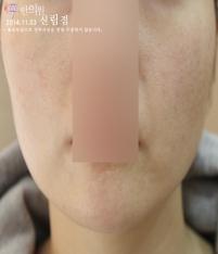 전후사진