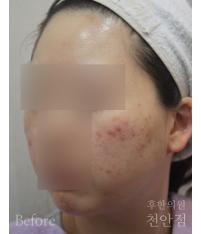 전후사진