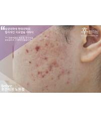 전후사진