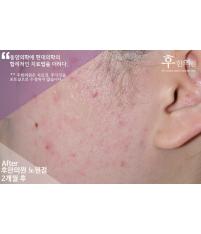 전후사진