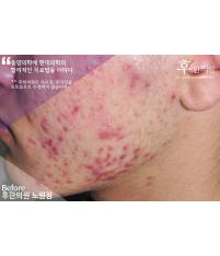 전후사진