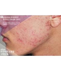 전후사진