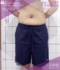 전후사진