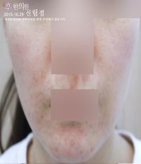 전후사진