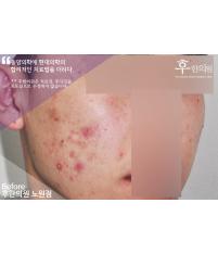 전후사진