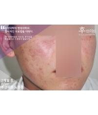 전후사진