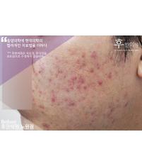 전후사진