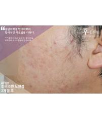 전후사진