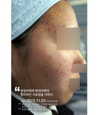전후사진