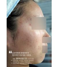 전후사진