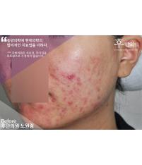전후사진
