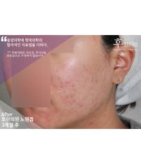전후사진