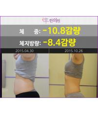 전후사진
