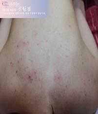 전후사진