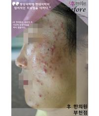 전후사진
