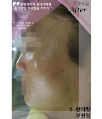 전후사진