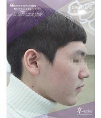 전후사진