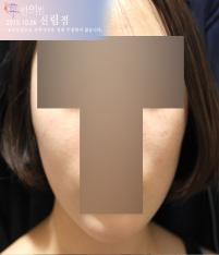 전후사진