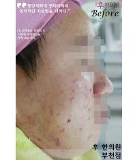전후사진