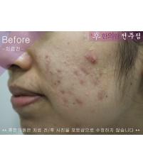 전후사진