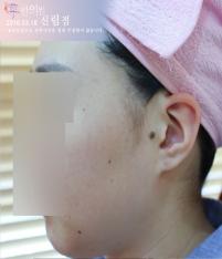 전후사진
