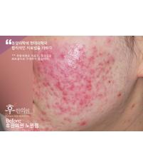 전후사진