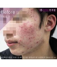 전후사진