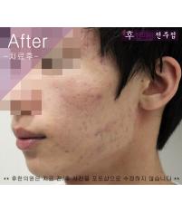 전후사진
