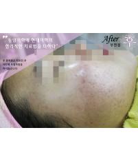 전후사진