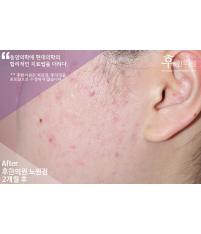 전후사진