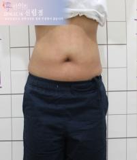 전후사진