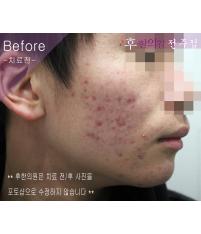 전후사진