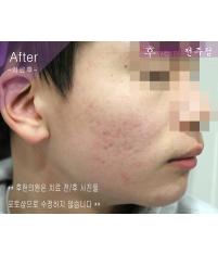 전후사진