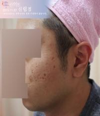 전후사진