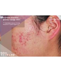 전후사진