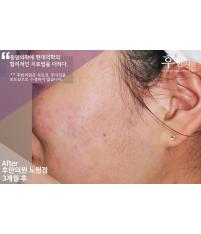 전후사진