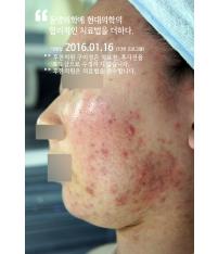 전후사진