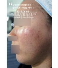 전후사진