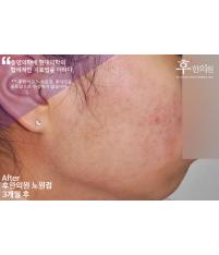 전후사진