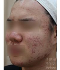 전후사진